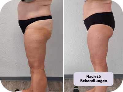 Behandlung